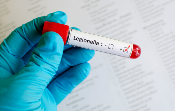 Legionella Risk Assessment and Testing