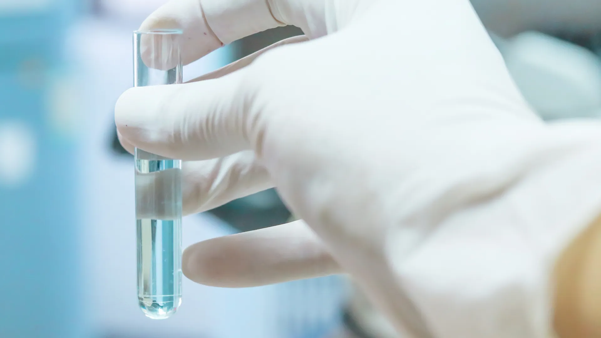 Legionella Water Test Tube