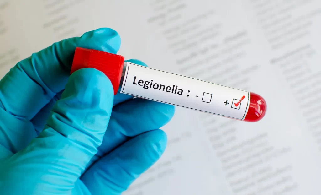 Legionella Test